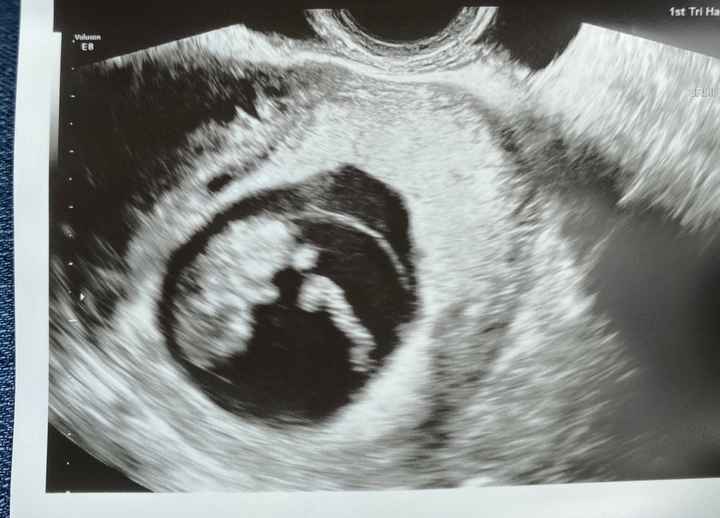Future mamme novembre 2020 🌞🍁🌷♾ - 2
