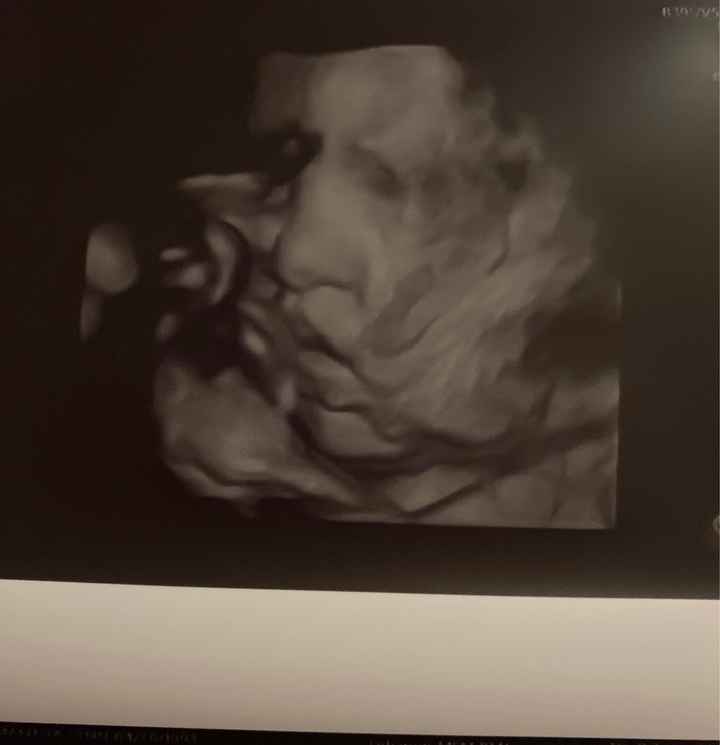 Future mamme novembre 2020 🌞🍁🌷♾ - 1