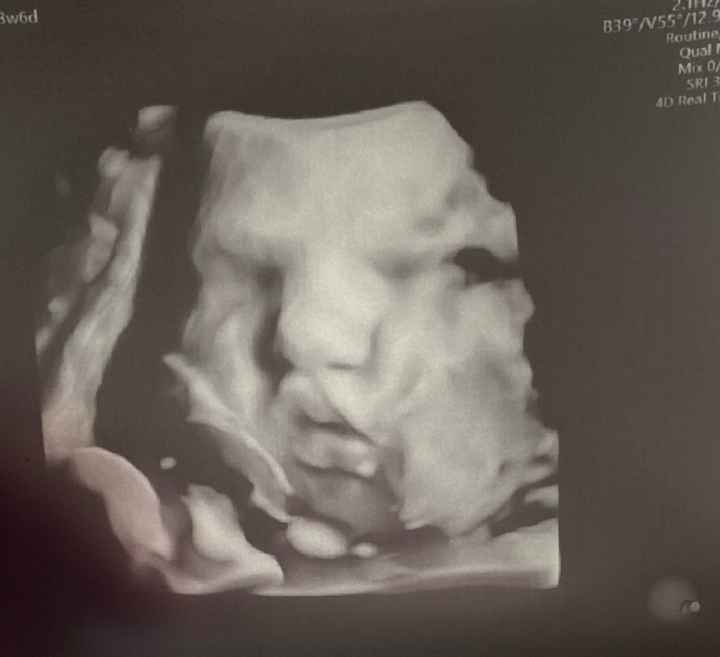 Future mamme novembre 2020 🌞🍁🌷♾ - 1