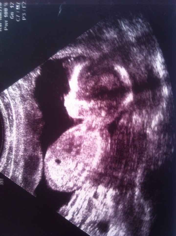 Ecco il mio bimbo - 1