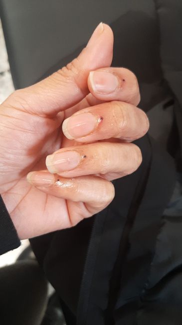 Ricostruzione unghie..help me😱🥶 - 1
