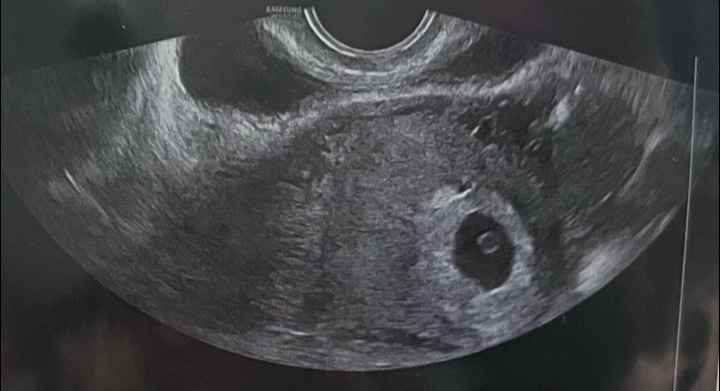 Esperte di Metodo Ramzi ci siete? - 1