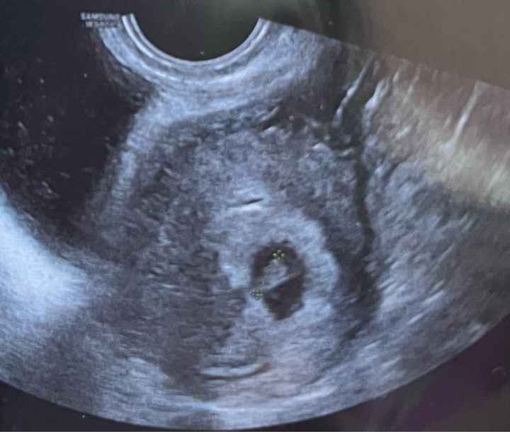 Esperte di Metodo Ramzi ci siete? - 2