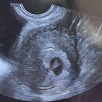 Esperte di Metodo Ramzi ci siete? - 2