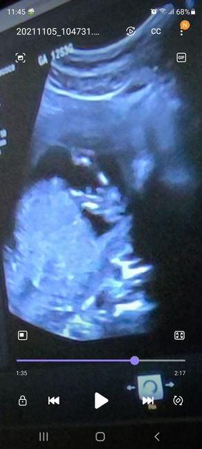💙💜future mamme di Maggio 2022💙💜 - 1