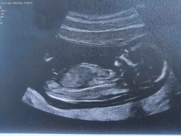 Nub theory secodo voi boy o girl? - 1