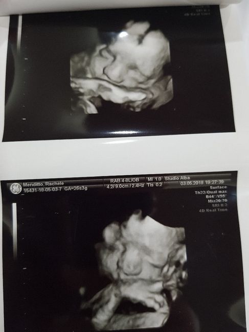 Future mamme agosto 2018! - 1