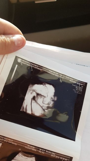 Future mamme agosto 2018! - 1