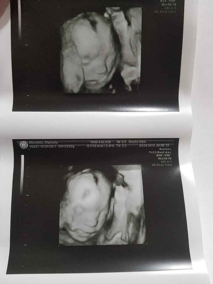 Controllo 6 mese! - 1