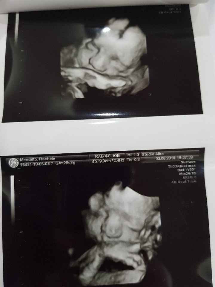 Future mamme agosto 2018! - 1