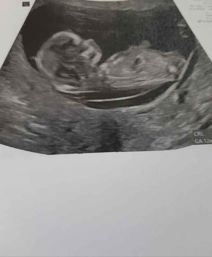 💙💜future mamme di Maggio 2022💙💜 - 1