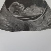 💙💜future mamme di Maggio 2022💙💜 - 1