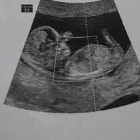 💙💜future mamme di Maggio 2022💙💜 - 1