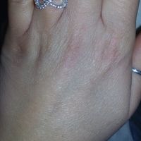 I vostri anelli di fidanzamento: vogliamo vederli! - 1