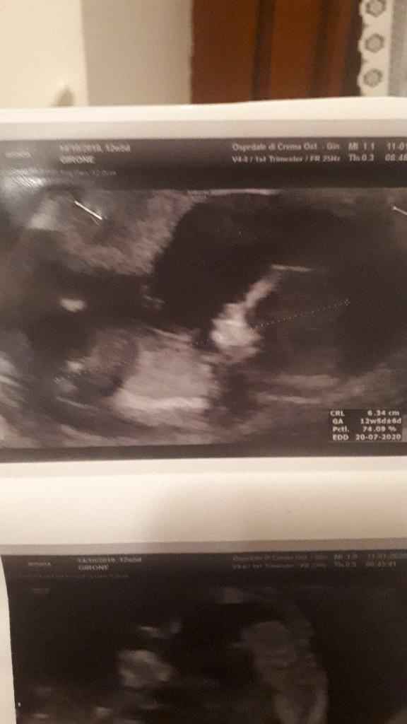 Esperte di Nub Theory a me 9