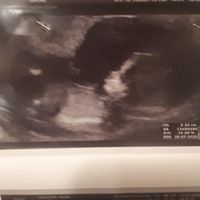 Nub theory curiosità - 1