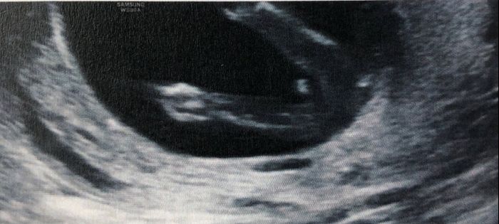 Mammine di febbraio 2020 - 2