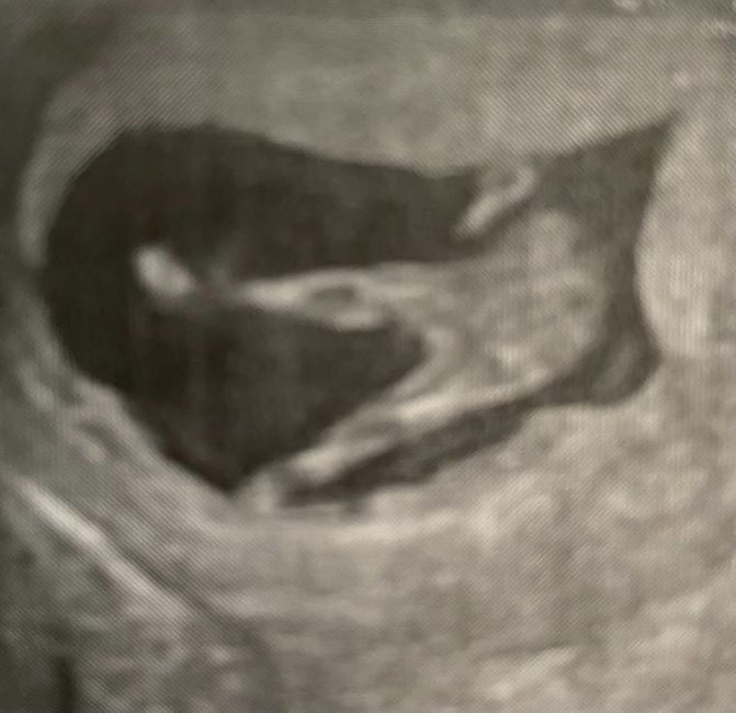 Future mamme Dicembre 2022 - 2