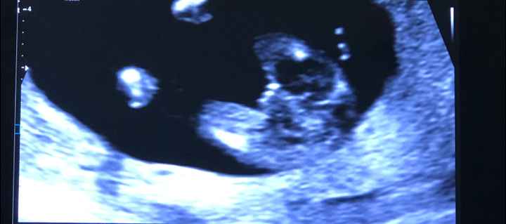 Mammine di febbraio 2020 - 1