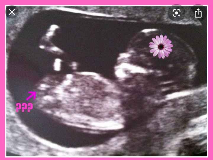 Esperte Nub Theory - 1