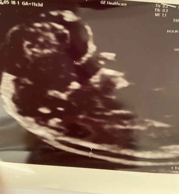 Future mamme Dicembre 2022 - 1