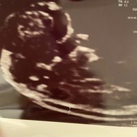 Future mamme Dicembre 2022 - 1