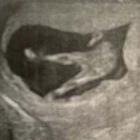 Future mamme Dicembre 2022 - 2