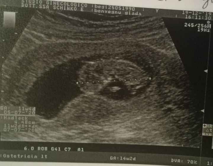 Mamme luglio 2020 - 1