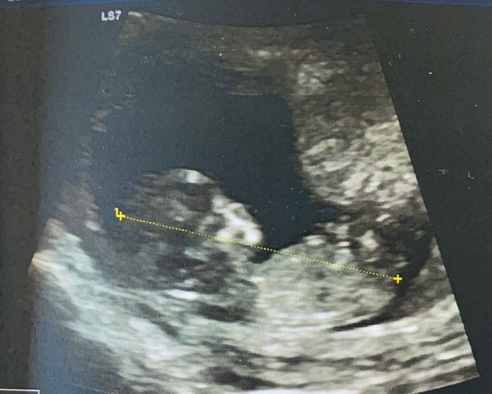 Future Mamme Settembre 2021😍 - 1