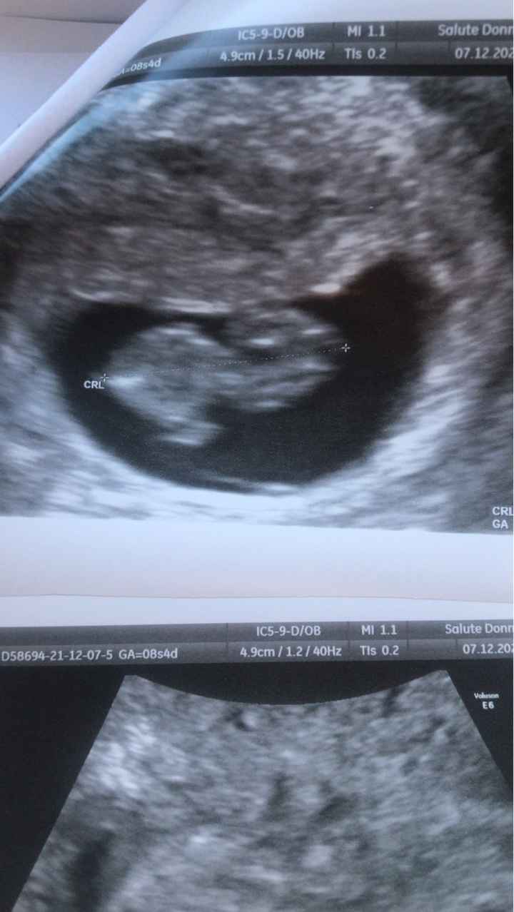 🍀Future mamme Luglio 2022🍀 - 1