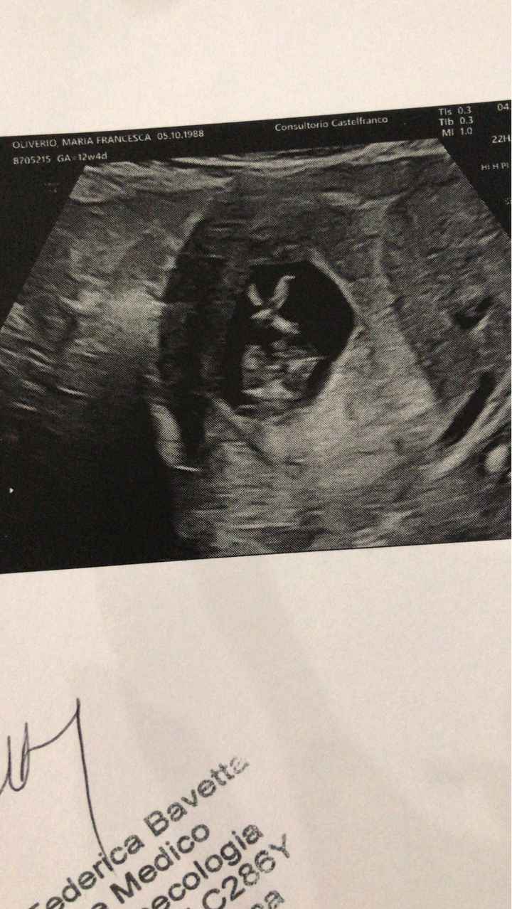 🍀Future mamme Luglio 2022🍀 - 2