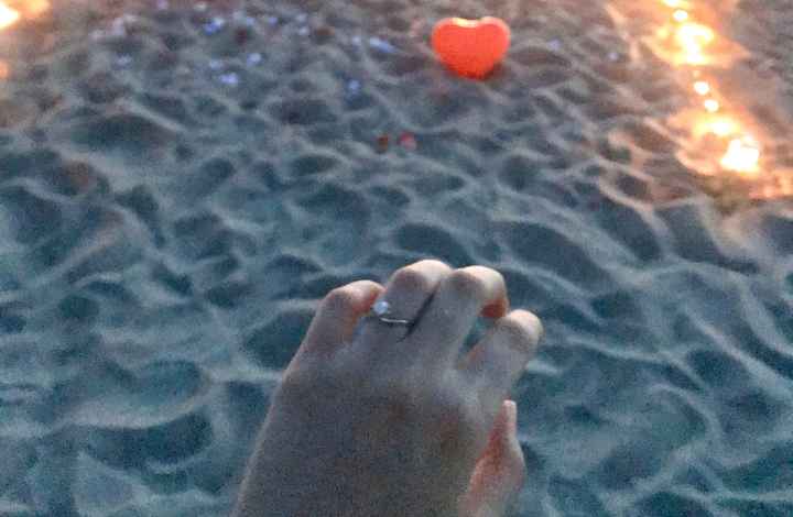 Anello findazamento - 1