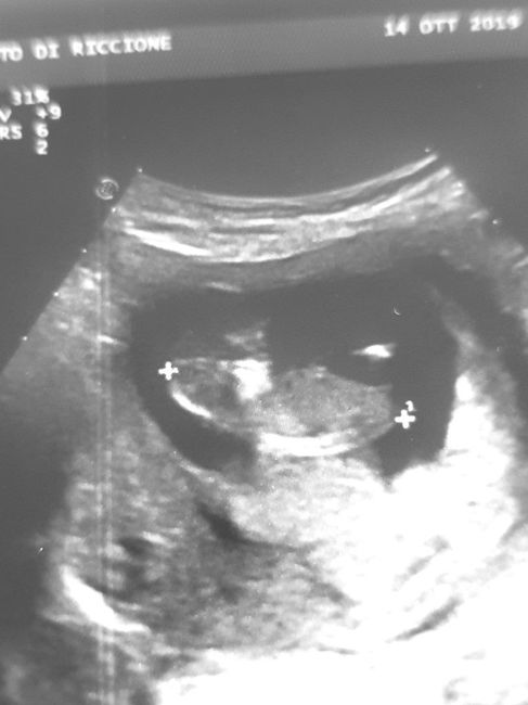 Esperte di Nub Theory a me 14