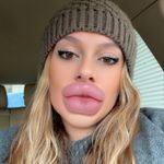 Federica