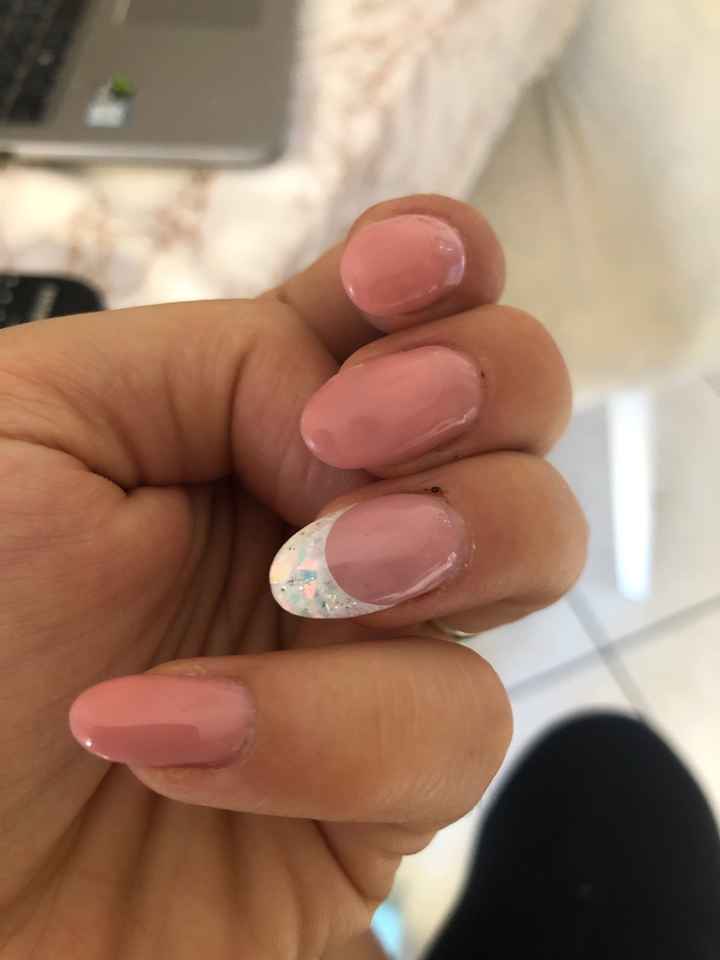 Avete mai sentito parlare del french  a muretto? - 1