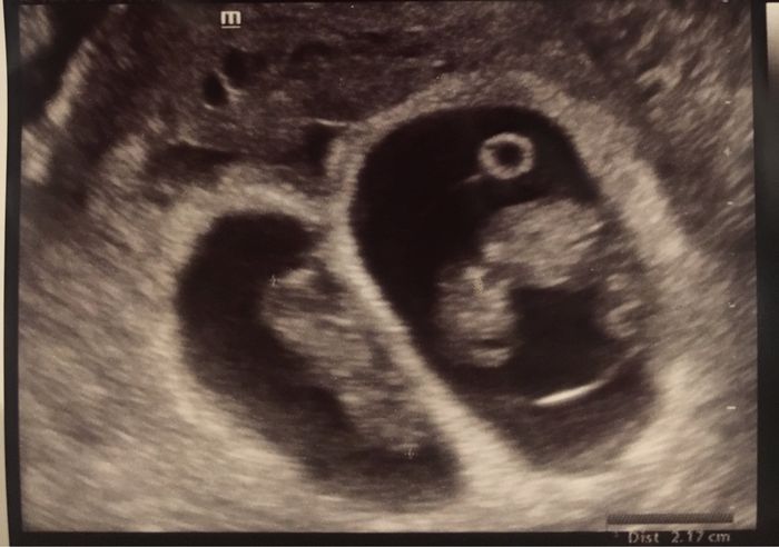 Metodo Ramzi eco 10+1 - 1