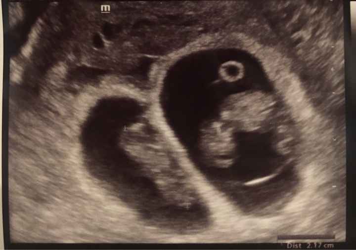 Metodo Ramzi eco 10+1 - 1