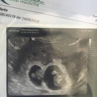 Metodo Ramzi eco 10+1 - 1