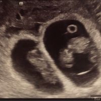 Metodo Ramzi eco 10+1 - 1