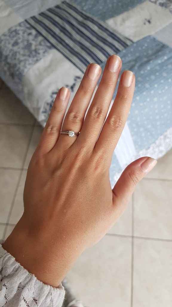 Il mio anello - 1