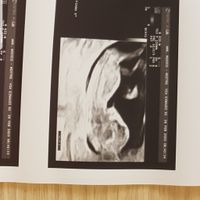 Esperte Nub Theory - 2