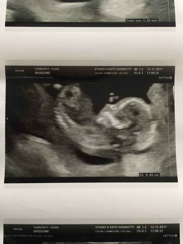  Future mamme maggio-giugno/2018 - 1