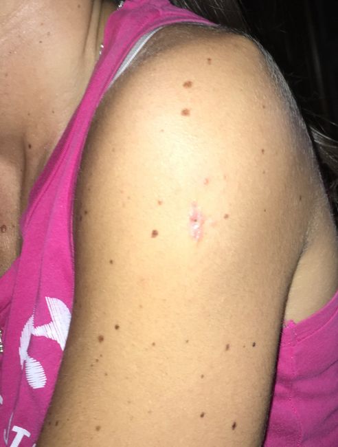 Segni e cicatrici - 1