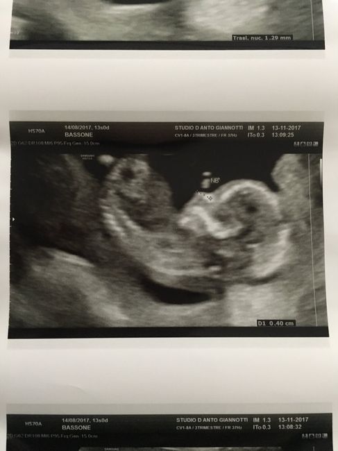 Future mamme maggio-giugno/2018 1