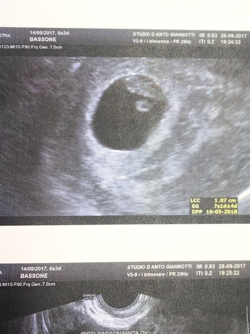 Prima ecografia 2