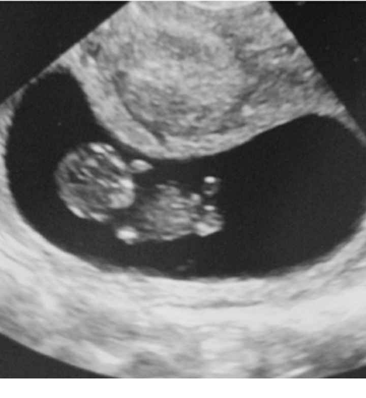 Future Mamme Dicembre 2020 ❤️😍 - 1