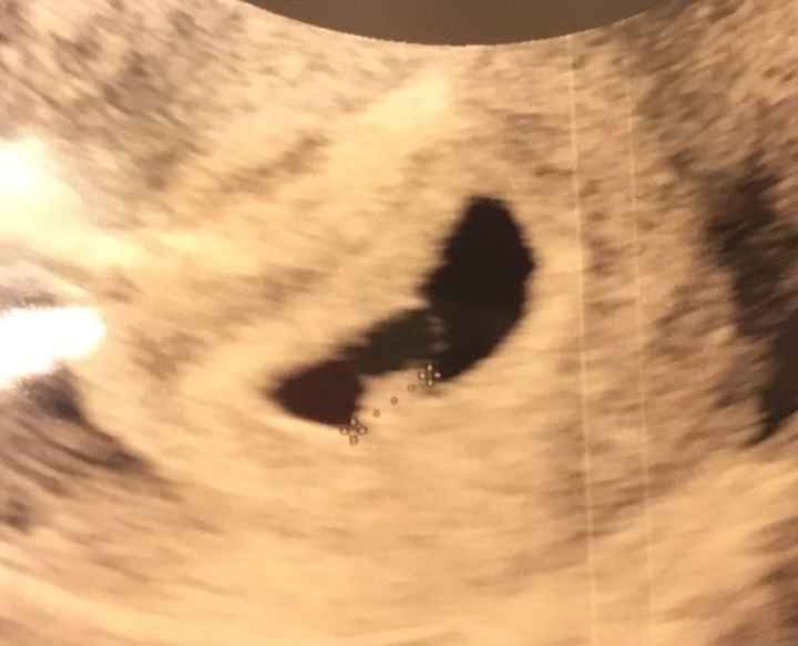 Prima eco *.*che emozioneeeee - 1