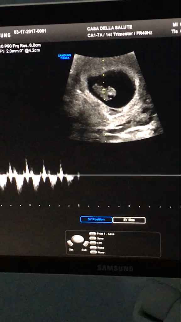 Ecco il mio fagiolino *.* - 1