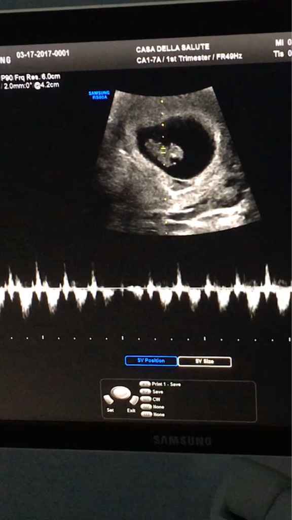 Ecco il mio fagiolino *.* - 2