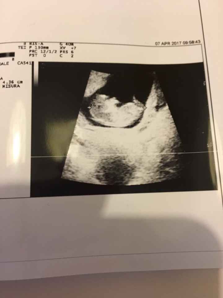 Fagiolino continua a crescere *.* - 2